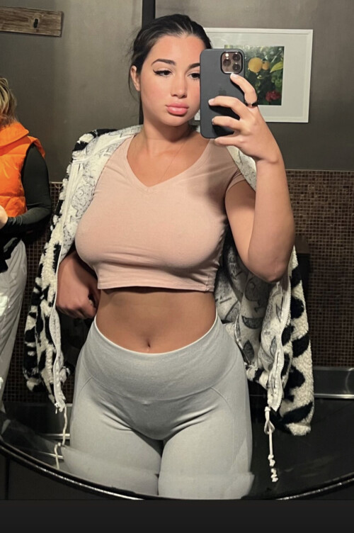 Liz | Lupuwellness Nude Leaked Onlyfans Photo