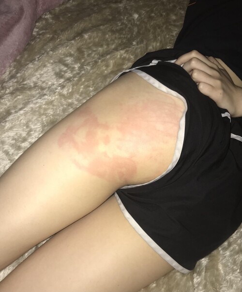 brattydeath2.0 | brattyydeath | brattydeath | cherry_grl Nude Leaked Onlyfans Photo